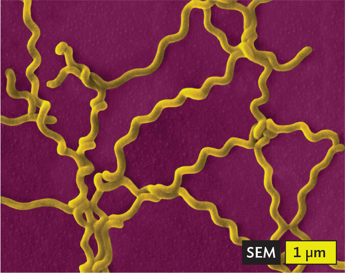 A scanning electron micrograph of Leptospira interrogans, an example of a spirochete.