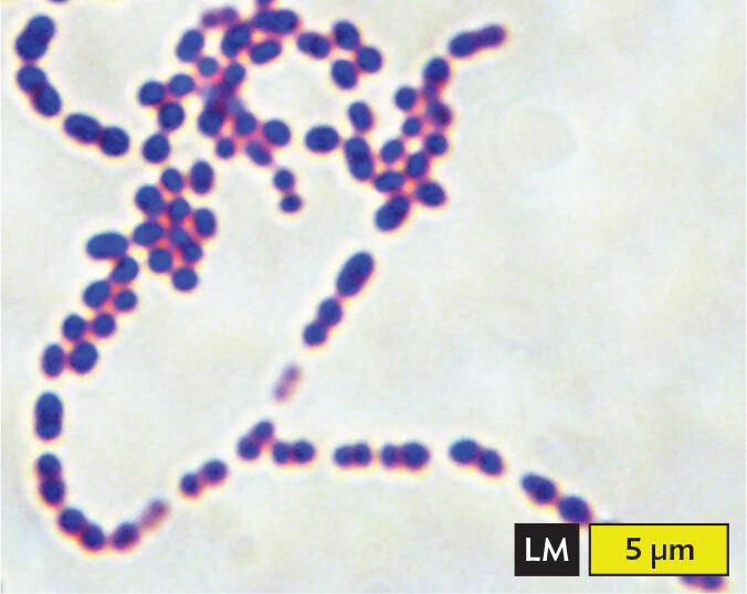 A light micrograph of Streptococcus pneumoniae, an example of cocci in chains or filaments.