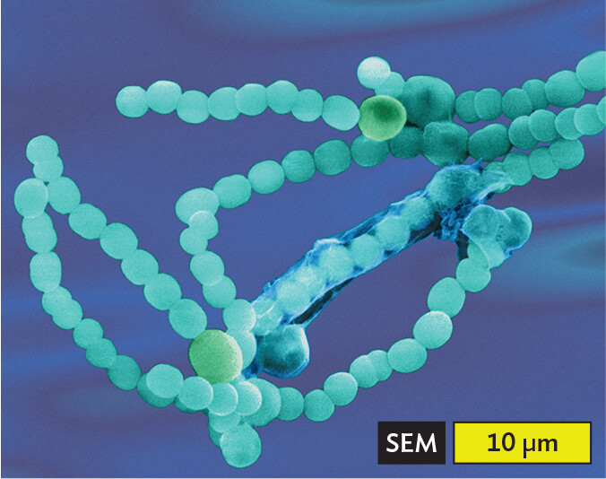 A scanning electron micrograph of Anabaena species of cyanobacteria, an example of cocci in chains or filaments.