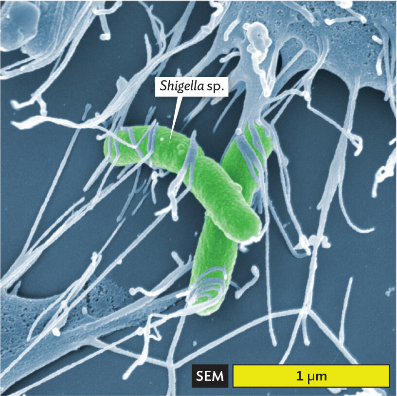 A scanning electron micrograph of Shigella bacteria.