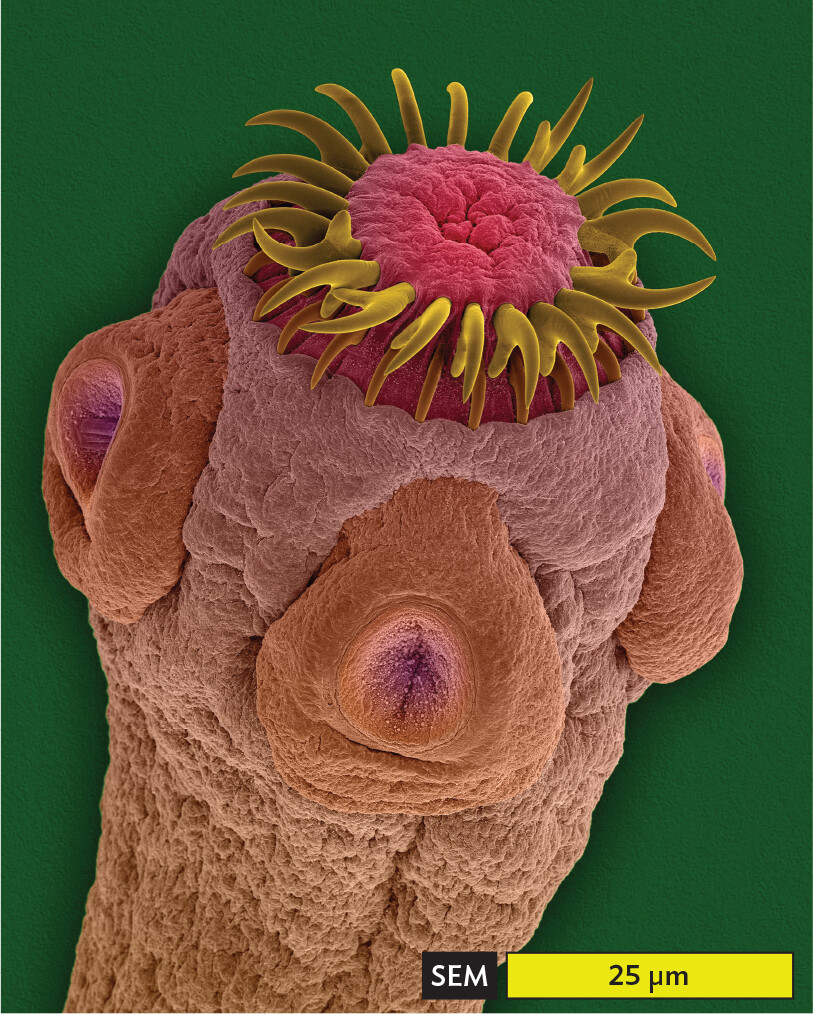 A scanning electron micrograph of the scolex of a tapeworm.