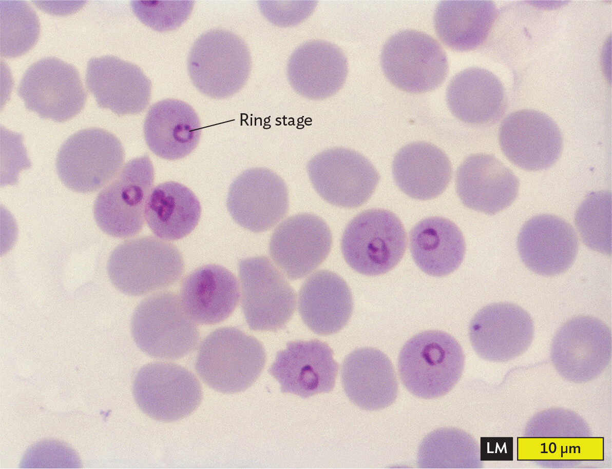 A light micrograph of the ring stage of Plasmodium falciparum inside red blood cells.