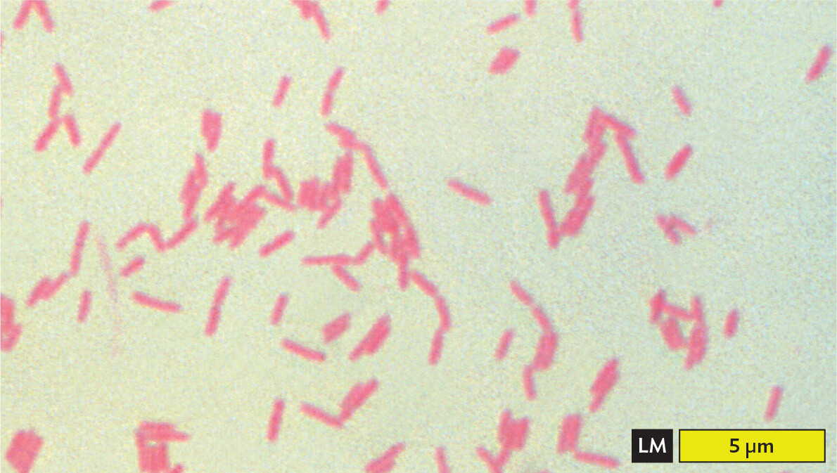 A light micrograph of Gram negative Pseudomonas aeruginosa cells.
