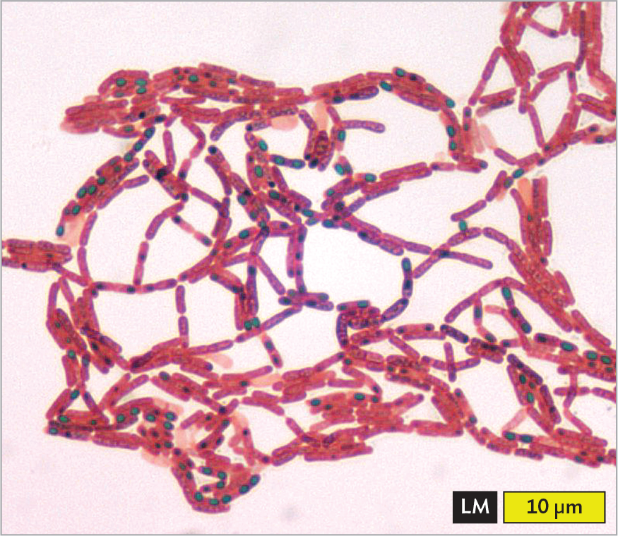 A light micrograph of Clostridium tetani stained with malachite green endospore stain.