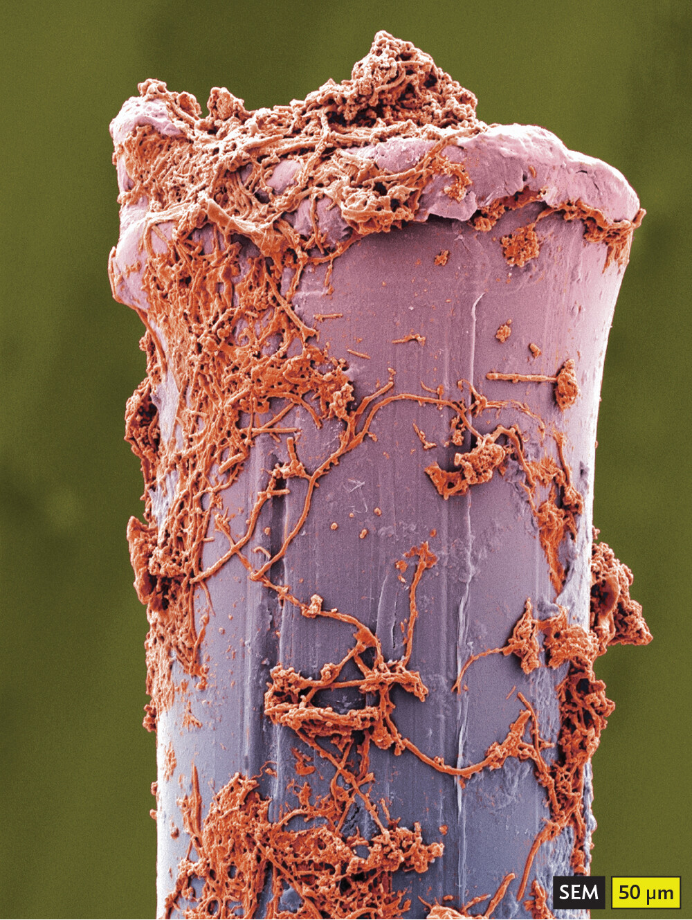 A scanning electron micrograph of bacteria on a toothbrush bristle.