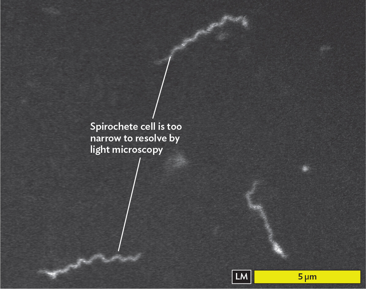 A light micrograph of Treponema pallidum cells as viewed under dark field observation.