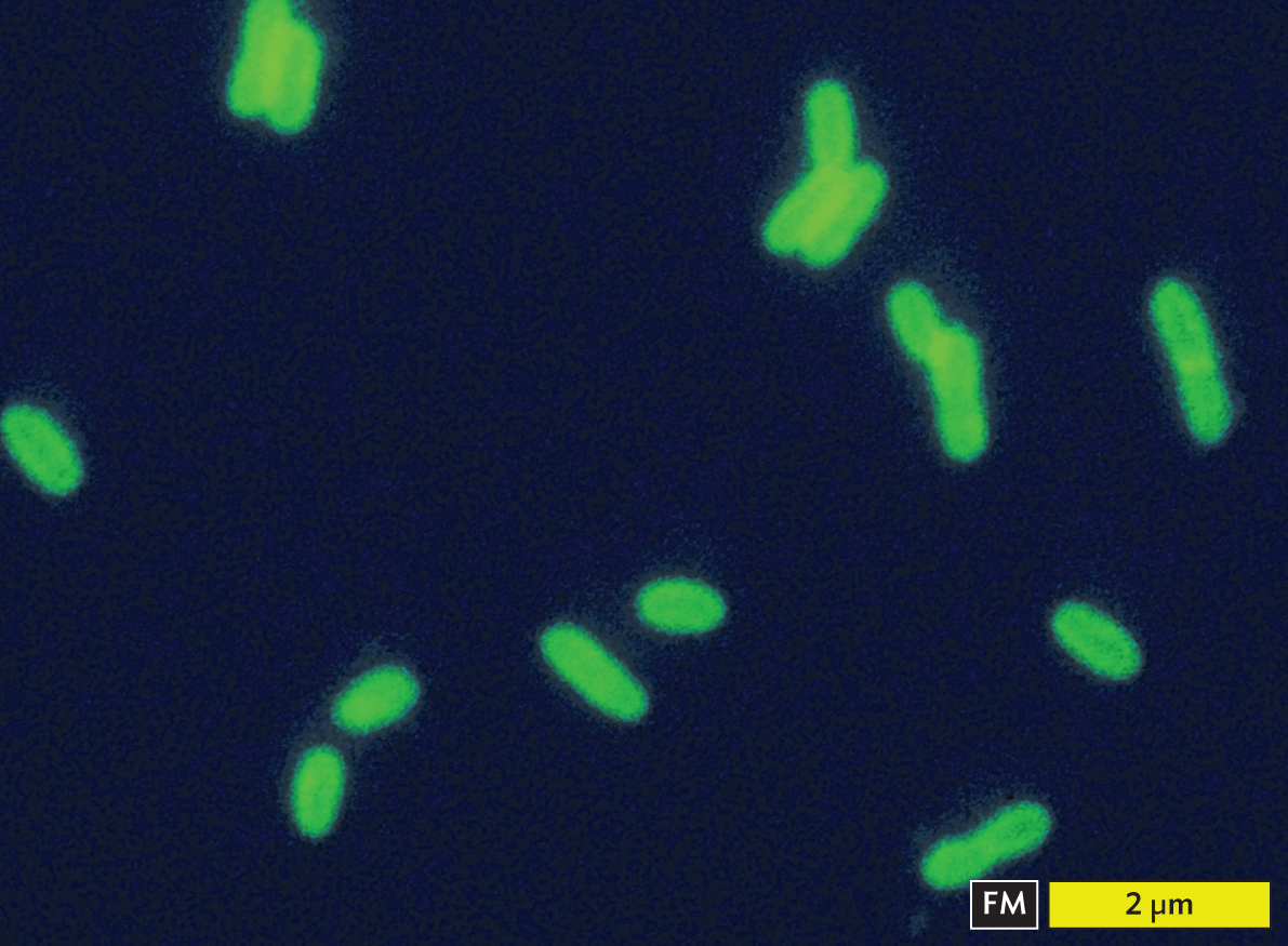 A fluorescence micrograph of Legionella pneumophila using direct fluorescent antibody stain.