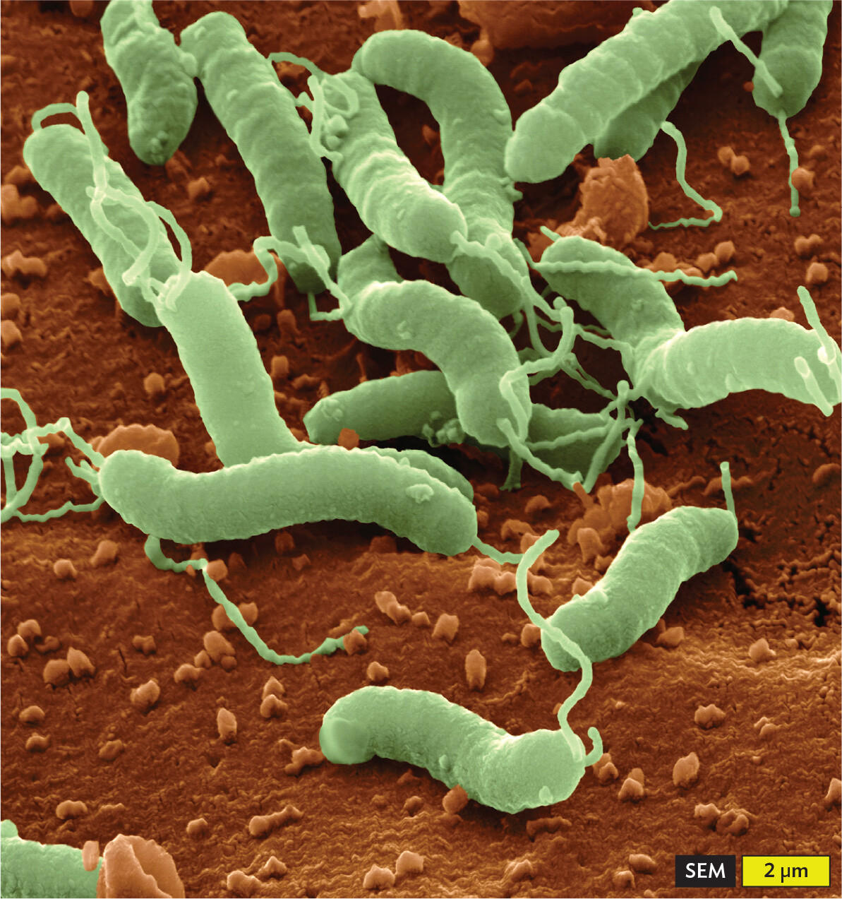 A scanning electron micrograph of Helicobacter pylori within the crypt cells of the stomach lining.