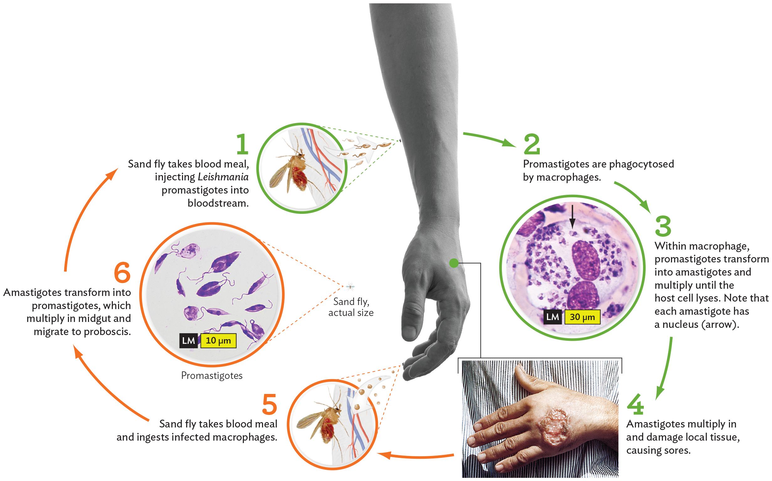 A diagram of the stages in the lifecycle of the Leishmania parasite.