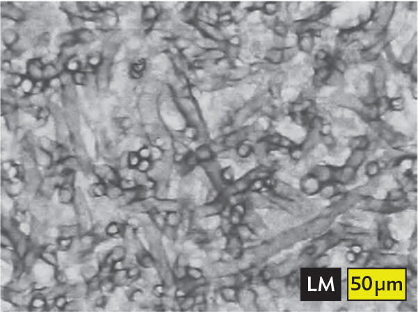 A light micrograph of Aspergillus mycelium invading the lungs.