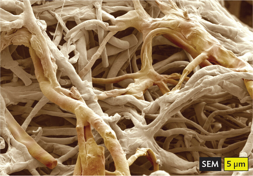 A scanning electron micrograph of fungal mycelium.