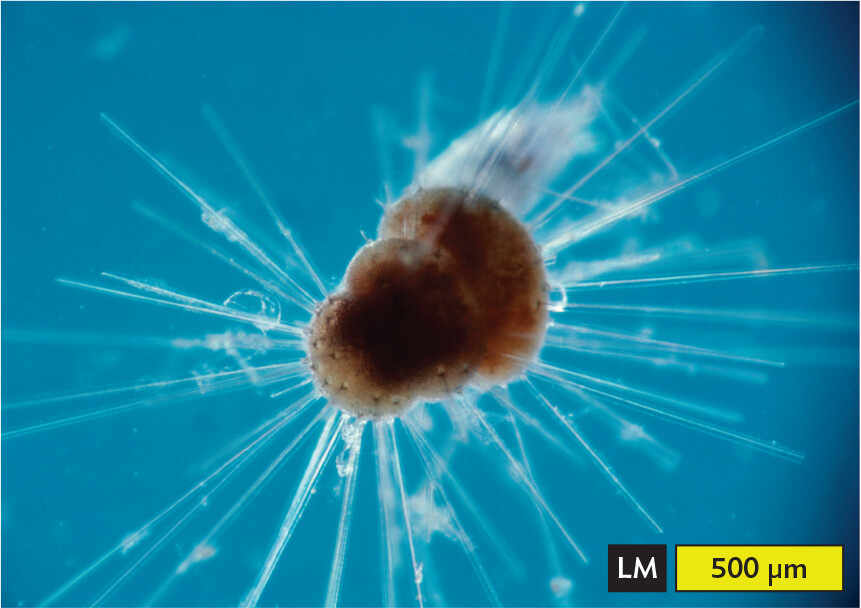 A light micrograph of the structure of a foraminiferan.