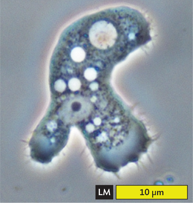 A light micrograph of Acanthamoeba.