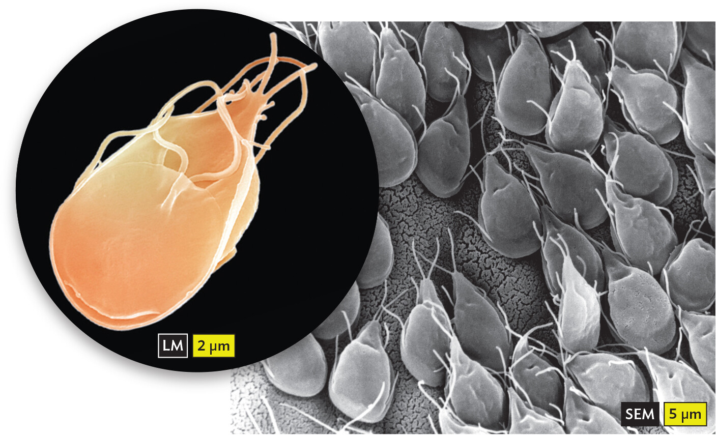 Two micrographs of Giardia intestinalis.