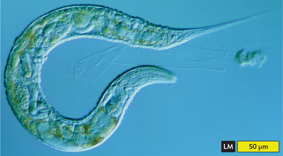 A light micrograph of the free living nematode Caenorhabditis elegans.