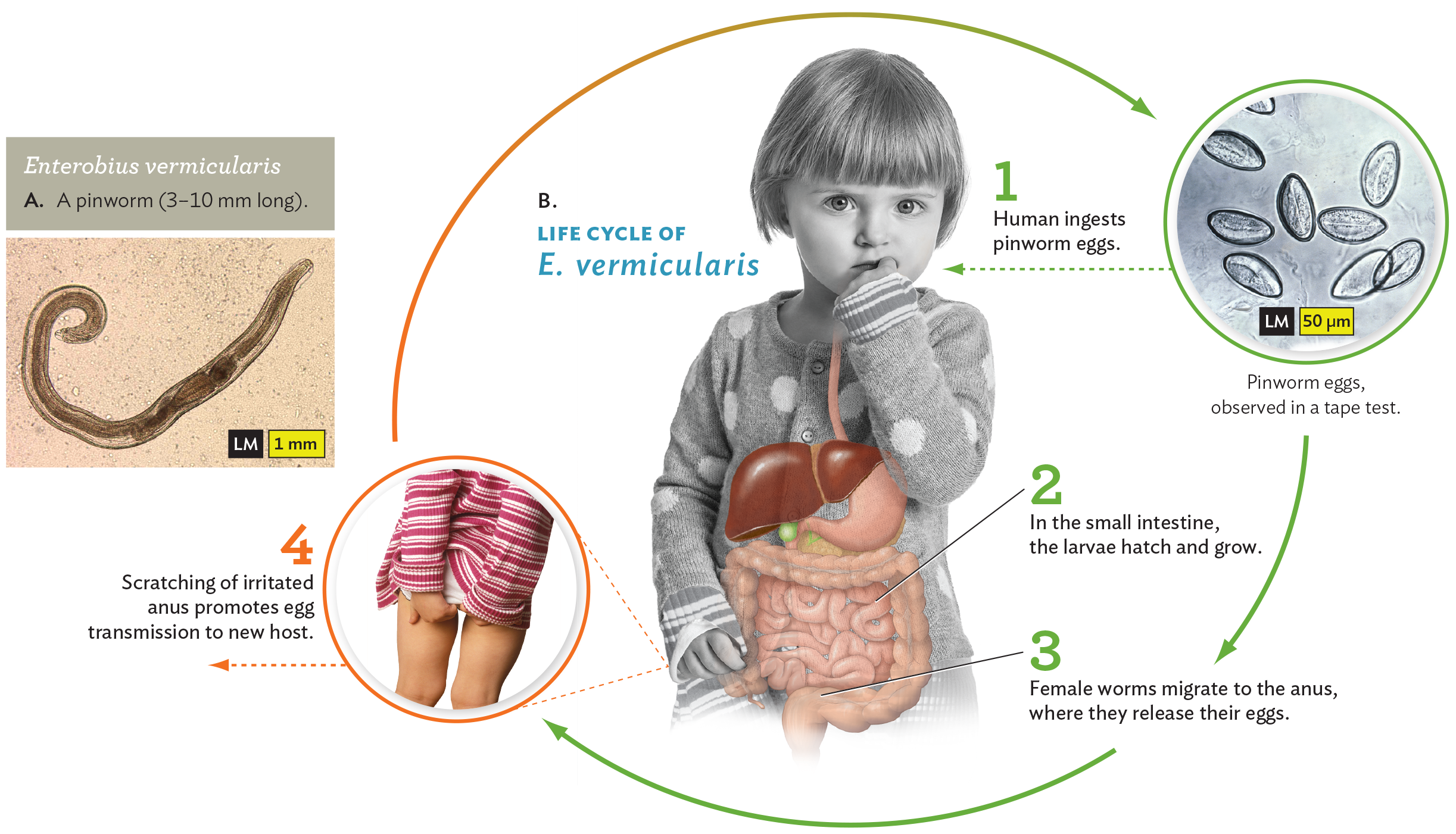 A light micrograph of Enterobius vermicularis and a diagram of its life cycle.
