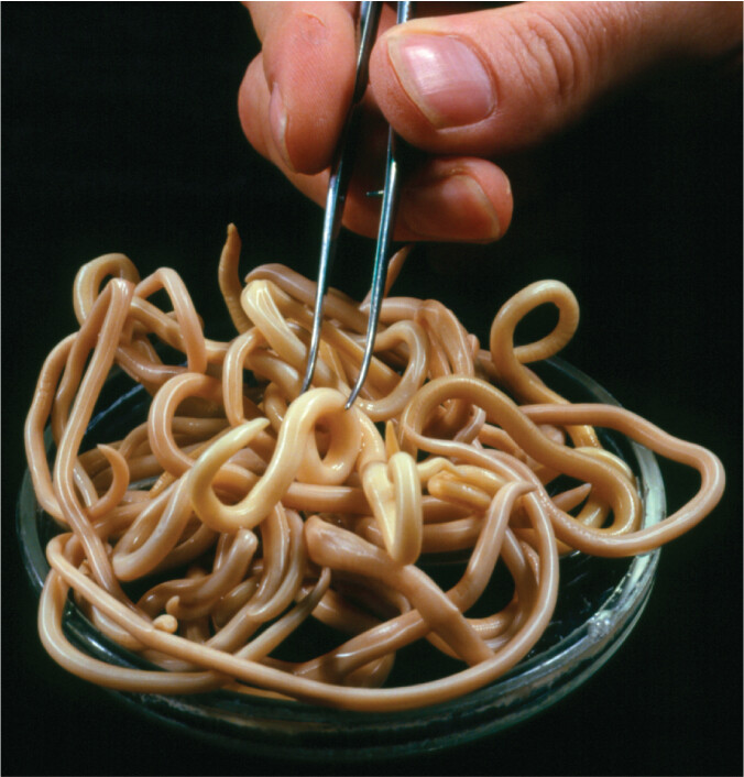 A photo of a pile of roundworms, Ascaris lumbricoides, on a Petri plate.