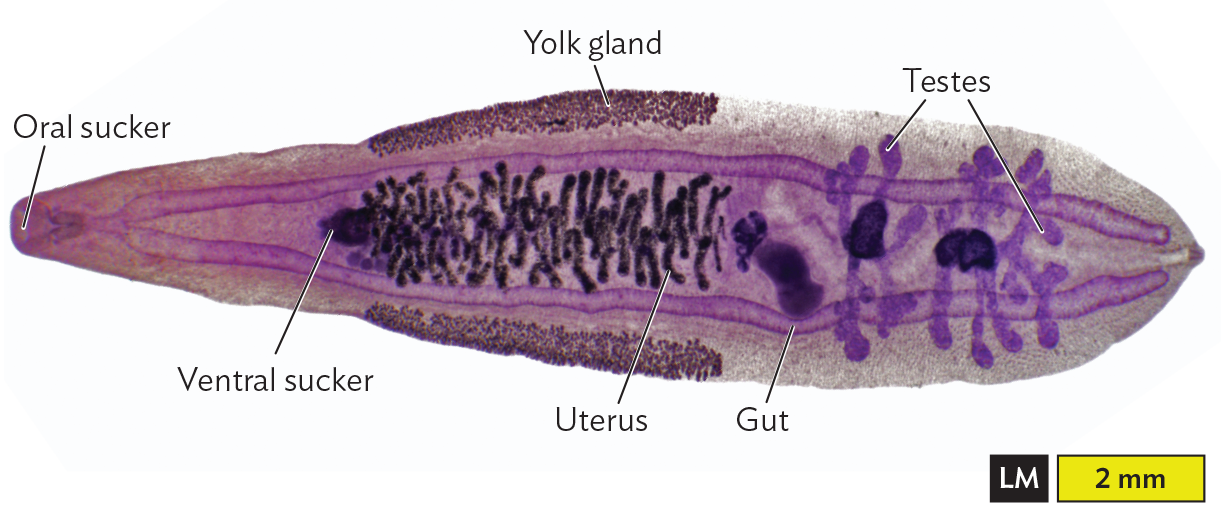 A labeled light micrograph of the structure of the liver fluke, Clonorchis sinensis.