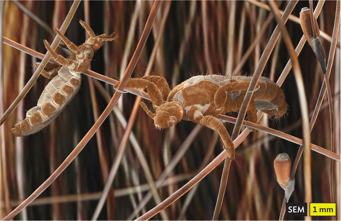A scanning electron micrograph of head lice on hair.