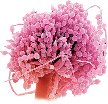 A scanning electron micrograph of Aspergillus.
