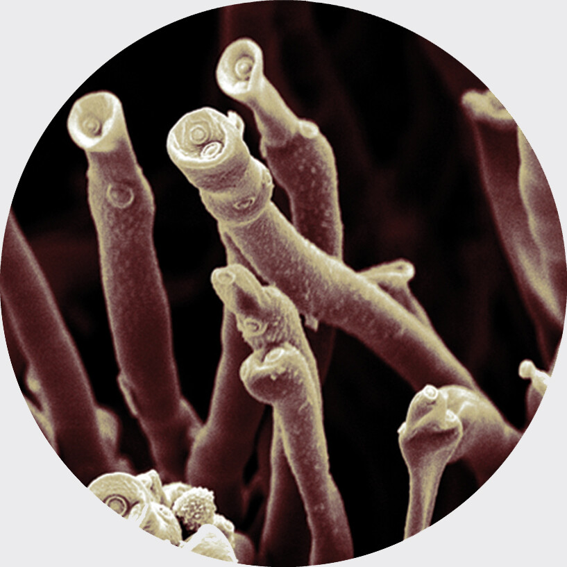 A micrograph of the structure of mold.