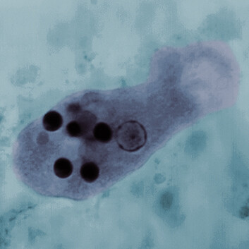 A light micrograph of Entamoeba histolytica.