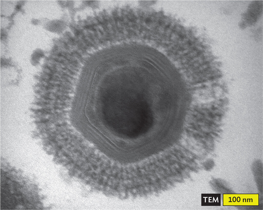 A transmission electron micrograph of a Mimi virus within an ameba.