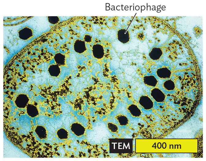A transmission electron micrograph of bacteriophage T 2 particles within an E coli cell.