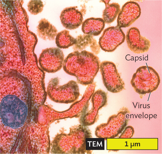 A transmission electron micrograph of Measles virions budding out of human cells.