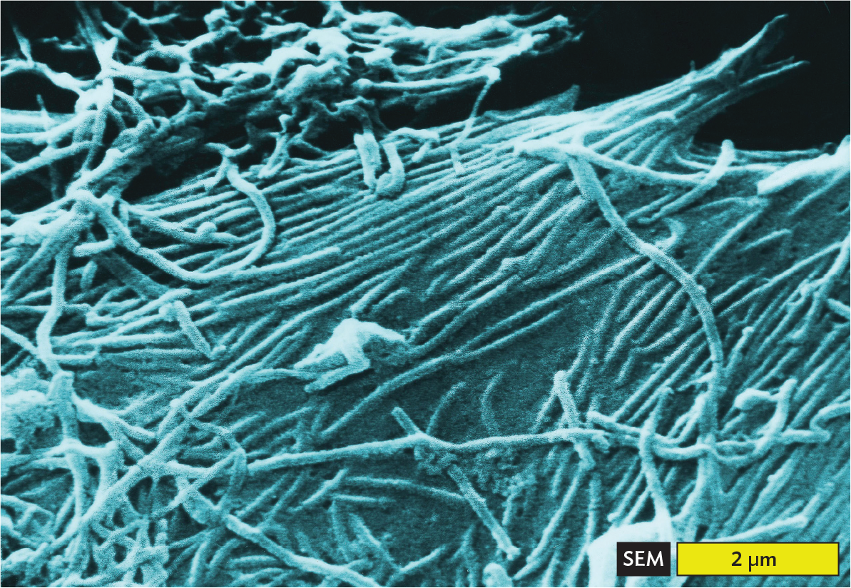 A scanning electron micrograph of Ebola virions.