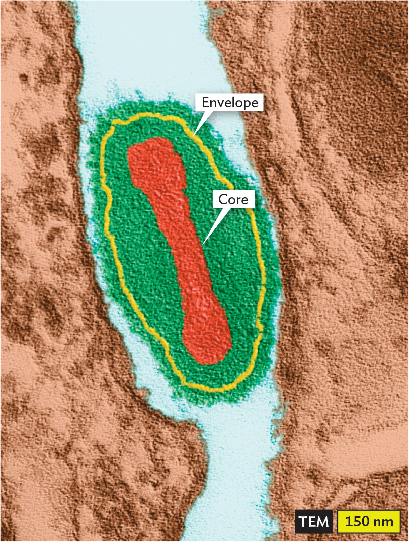 A transmission electron micrograph of a Vaccinia Virus particle.