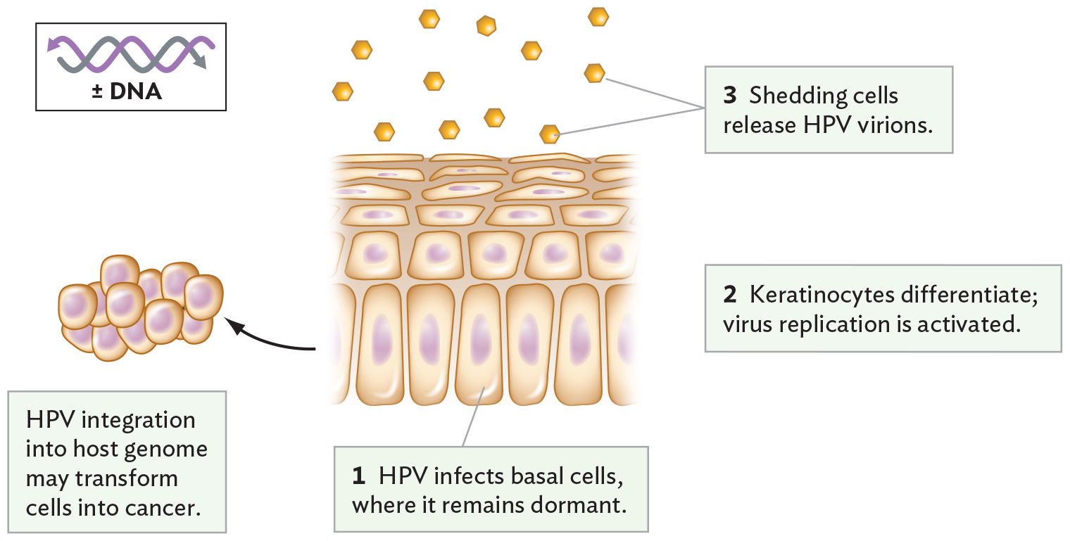 A diagram of human papilloma virus infecting basal epithelial cells.