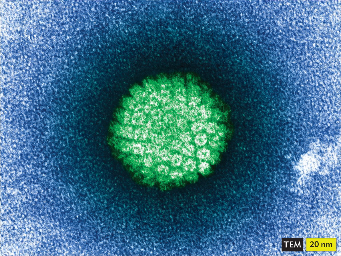 A transmission electron micrograph of an H P V virion.
