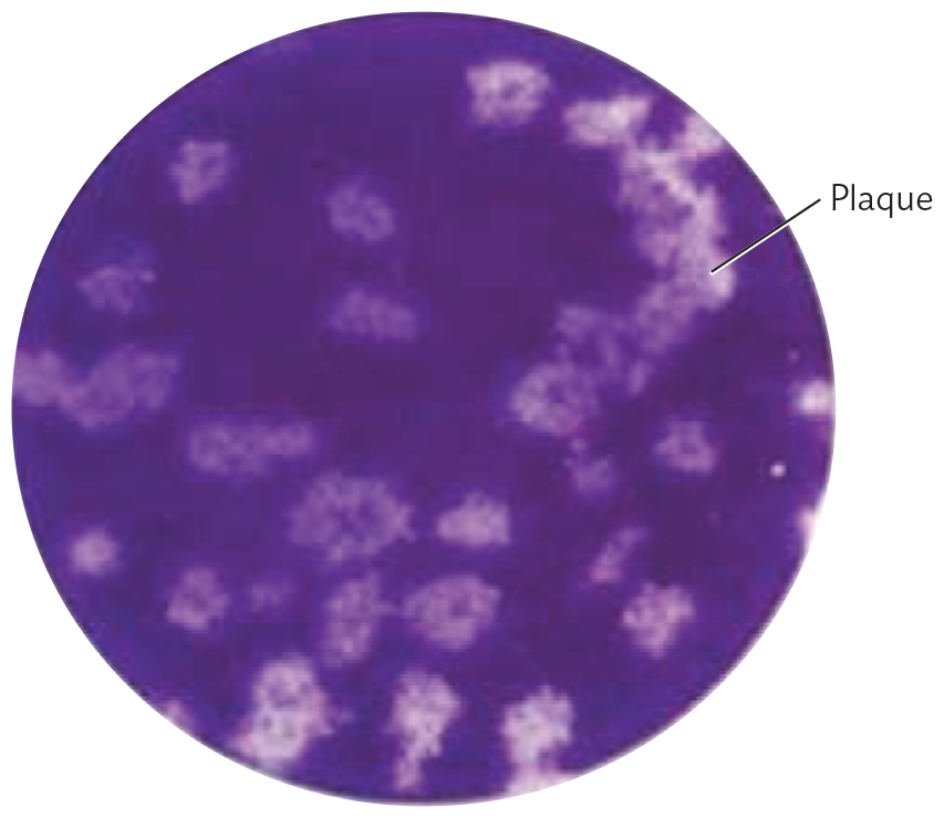 A photo of a plaque assay of human coronavirus H C o V N L 63 plated on colon carcinoma.