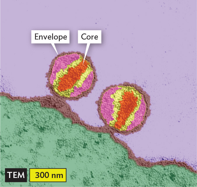 A transmission electron micrograph of H I V 1 particles.