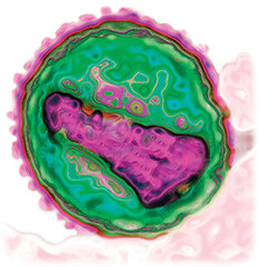 A transmission electron micrograph of an H I V virion.