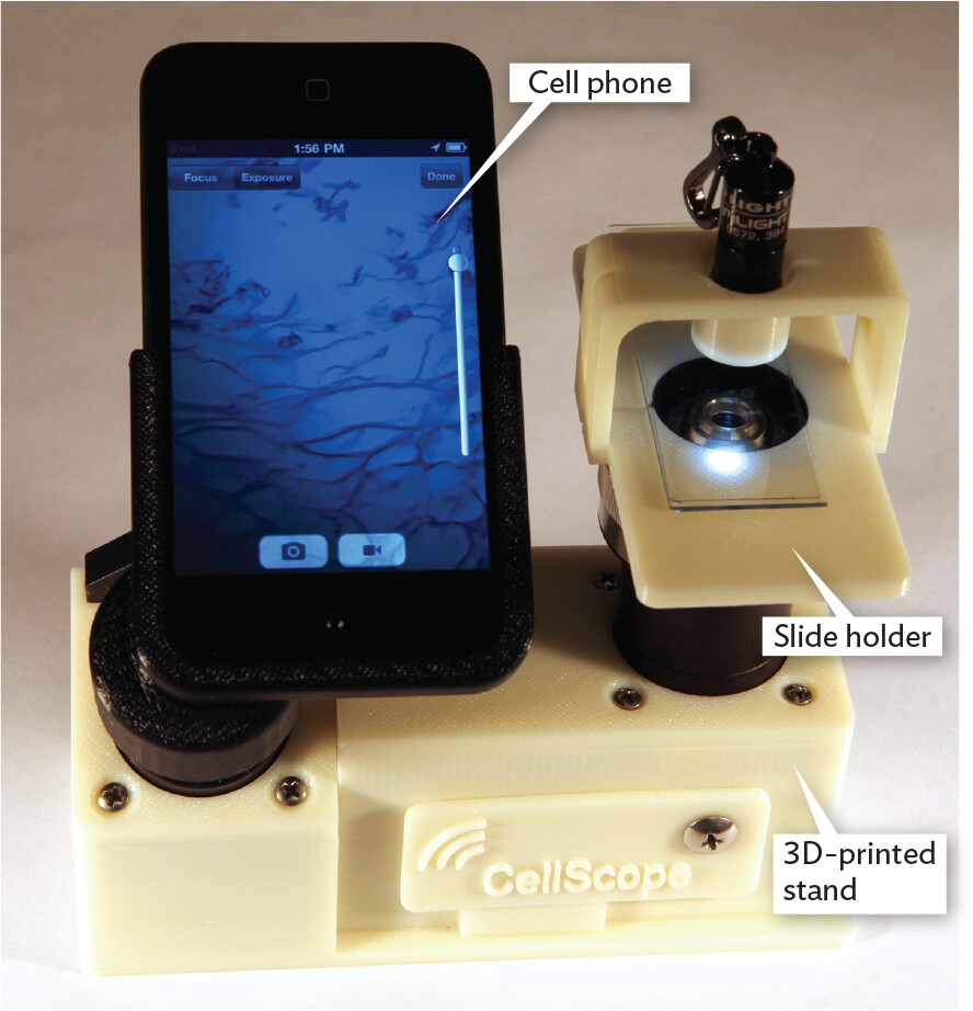 A photo of the Cell Scope, which is a microscope made from a cell phone.