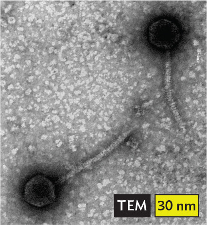 A transmission electron micrograph of phage lambda.