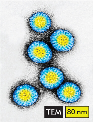 A transmission electron micrograph of Rotavirus.