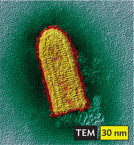 A transmission electron micrograph of Rabies virus.
