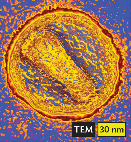 A transmission electron micrograph of human immunodeficiency virus.