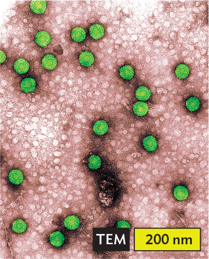 A transmission electron micrograph of Caulimovirus.