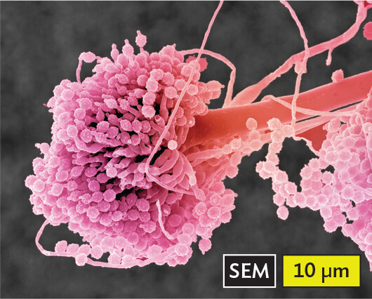 A scanning electron micrograph of Aspergillus, an example of a fungi.
