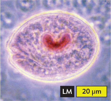 A light micrograph of Balantidium coli, an example of a ciliate.