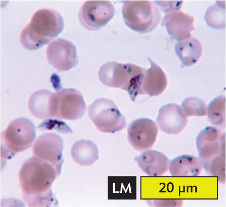 A light micrograph of Plasmodium falciparum, an example of an apicomplexan.