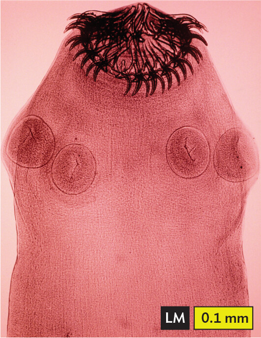 A light micrograph of Taenia solium, an example of a helminth.