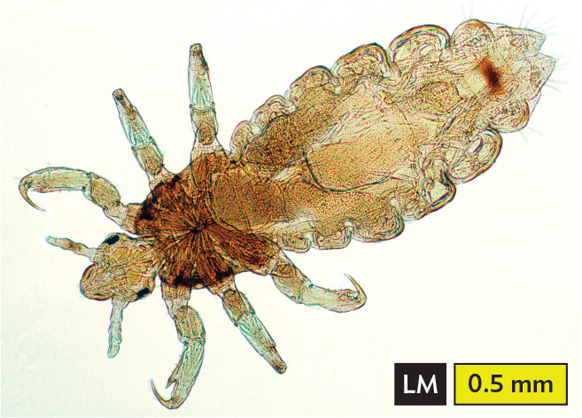 A light micrograph of a body louse, an example of an arthropod.