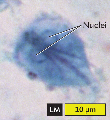A light micrograph of Giardia lamblia.