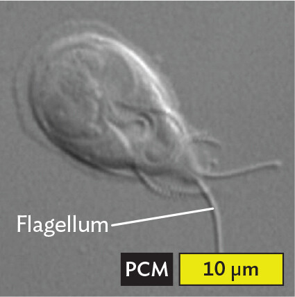 A phase contrast micrograph of Giardia lamblia.
