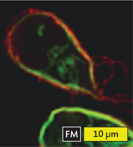 A fluorescence micrograph of Giardia lamblia.